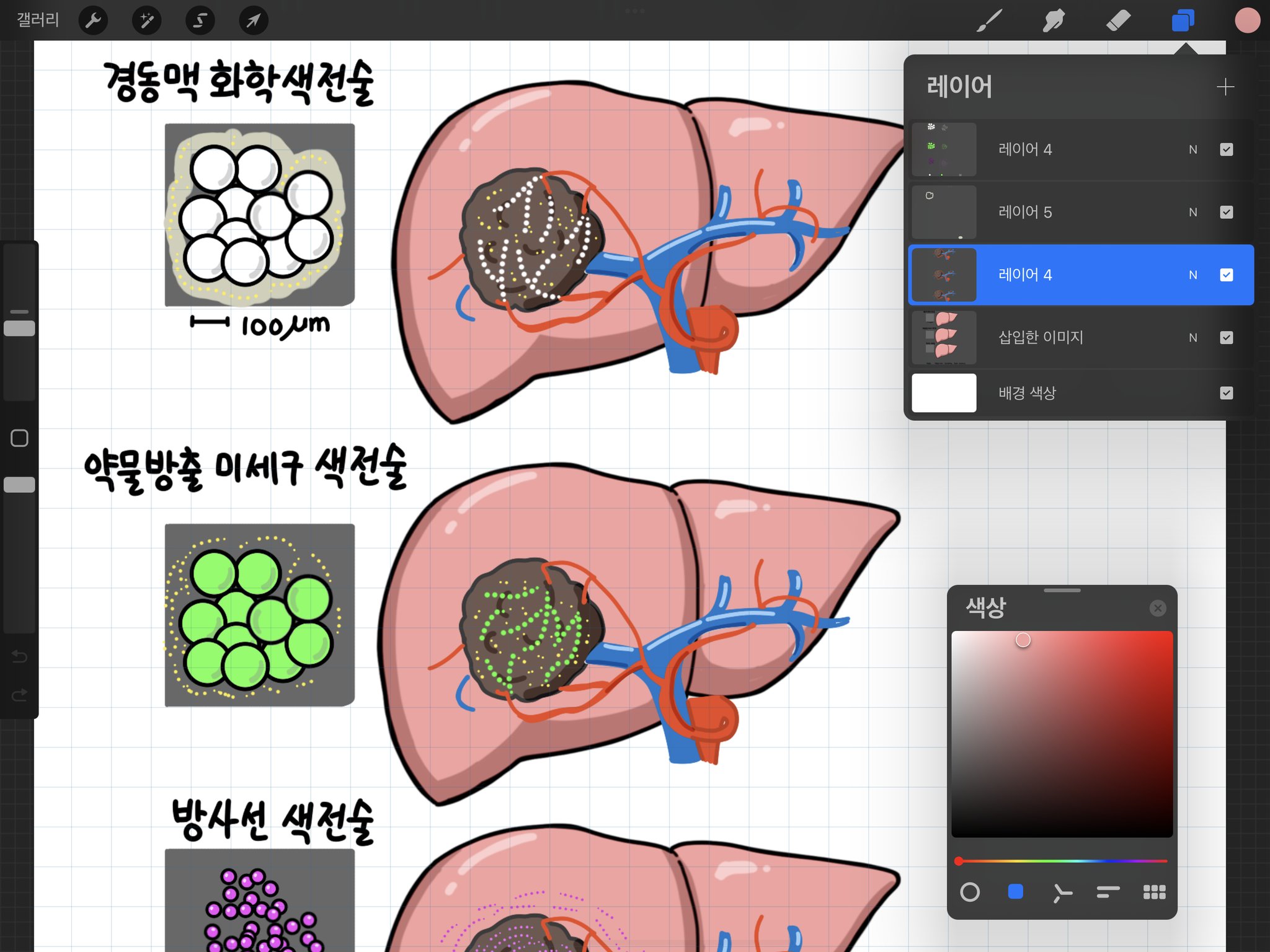 [출간] 간암 환문명답