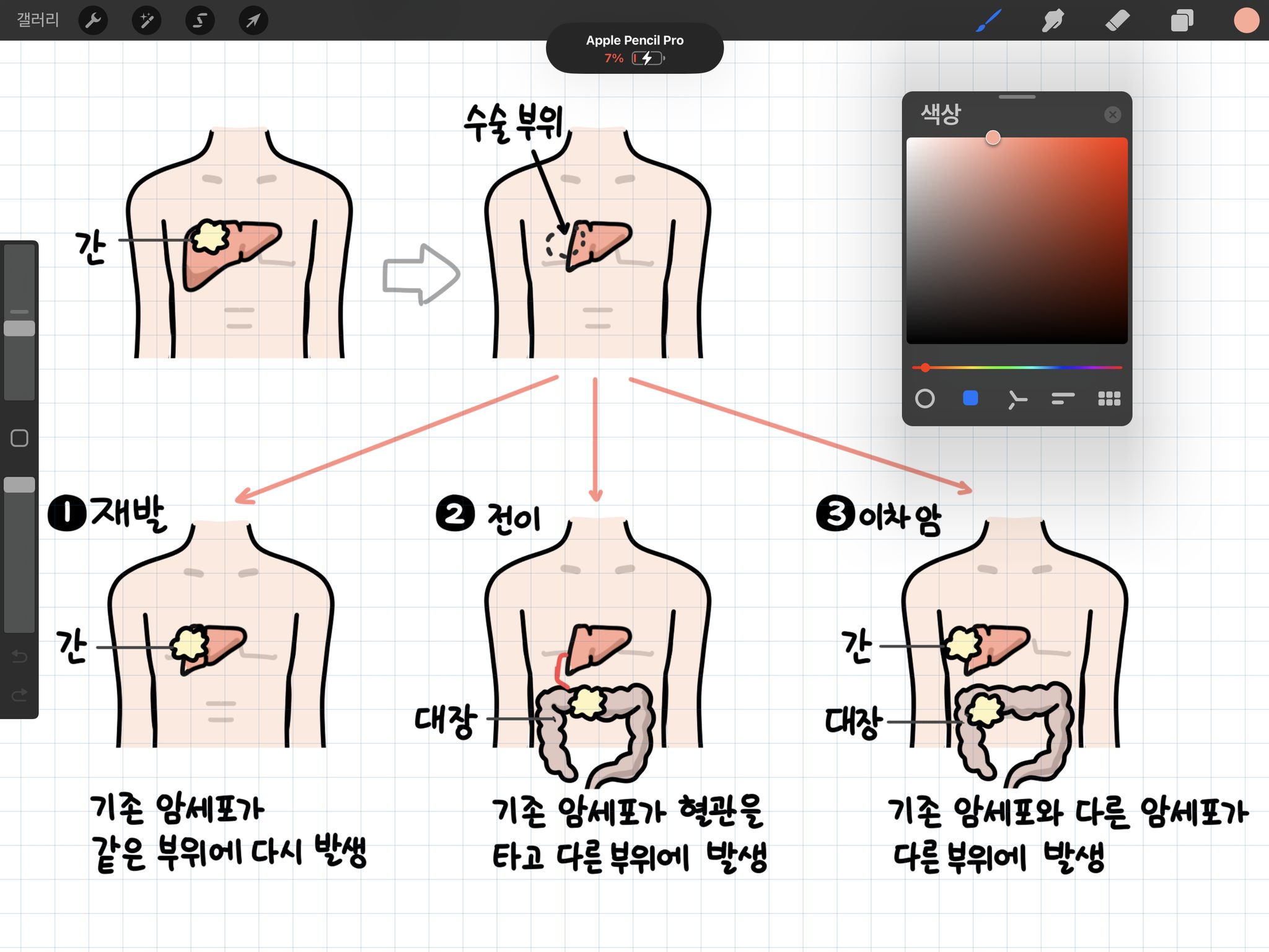 [출간] 간암 환문명답